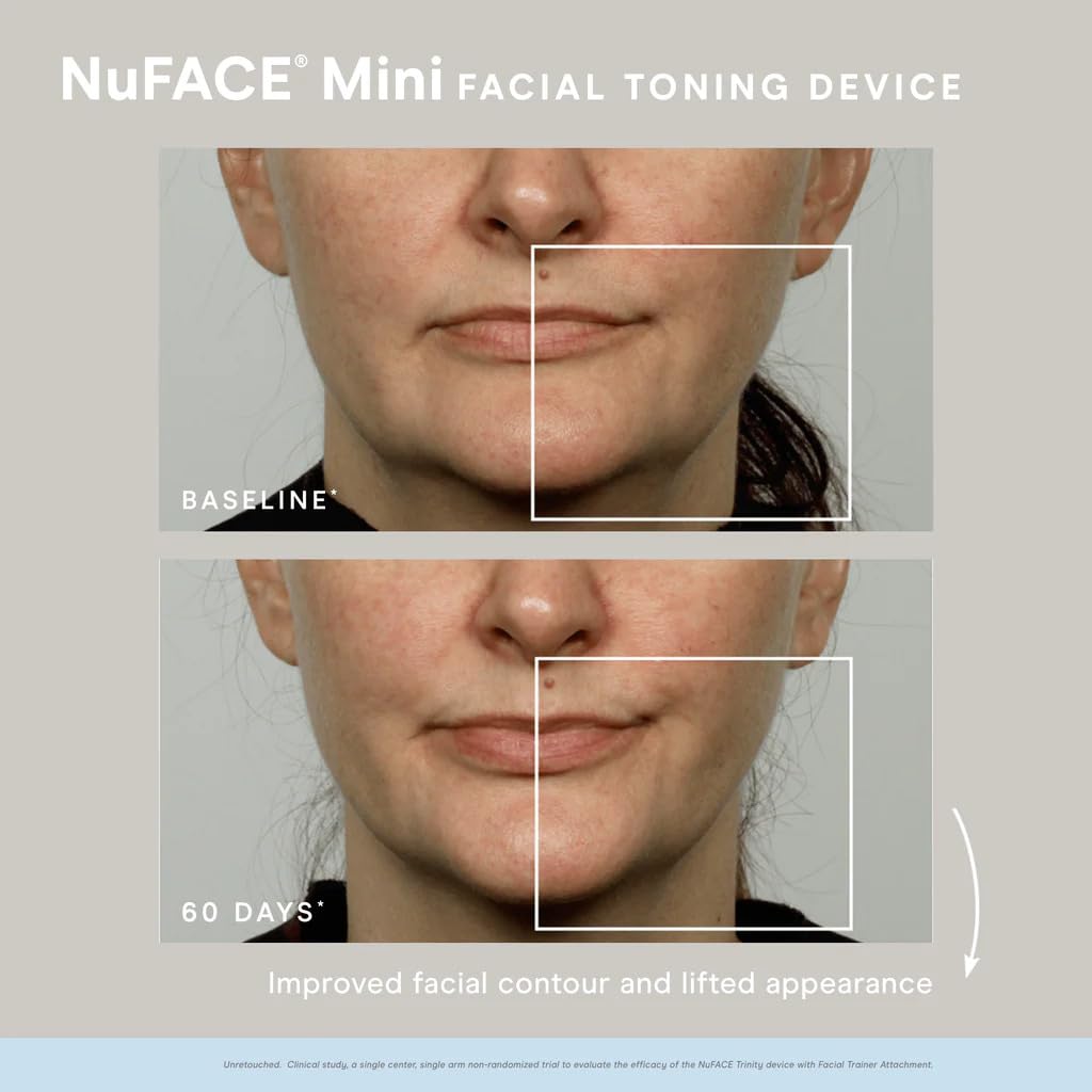 NuFACE MINI Starter Kit ,White